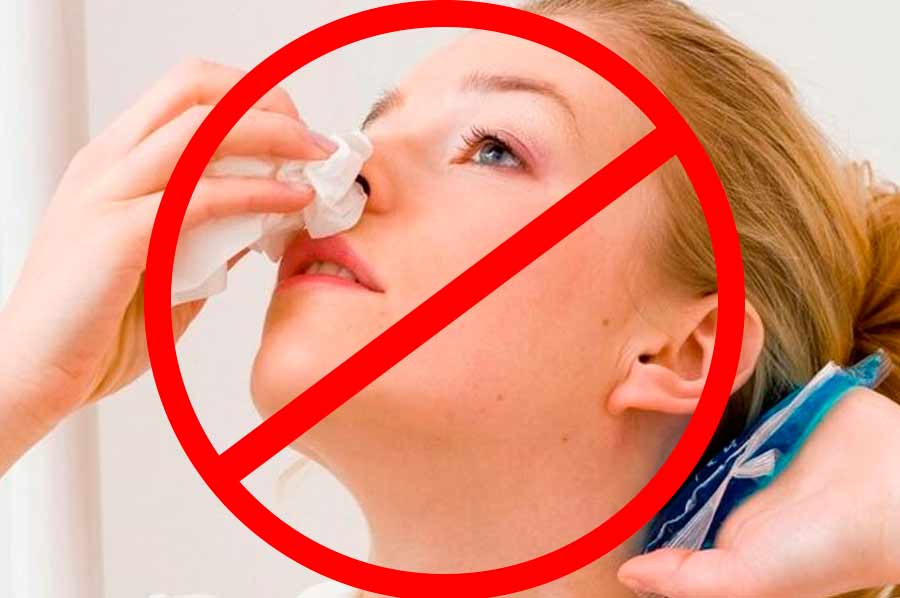 Как остановить и предотвратить внезапное кровотечение из носа?